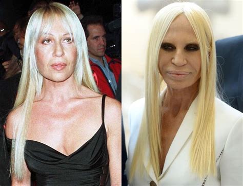 donatella versace face surgery|donatella versace before plastic surgery.